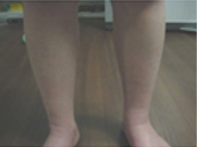 9세 남아 3일 경과 3